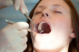 Girl at dentist with mouth open