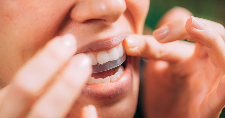 A female placing a Whitening teeth strip on her teeth